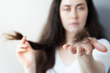 Saç problemi. Üzgün bir kadının bulanık portresi avucunun içinde düşmüş bir tutam saçı gösteriyor. Alopecia ve sebora kavramı..