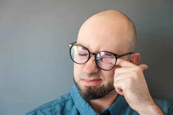 Portrait of Caucasian tired bald man lift his glasses and scratches dry tired eyes. Irritaton of sclera. Concept of vision problems and ophthalmology.