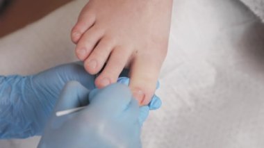 Pedikürcü ayak tırnaklarını pamuk çubuğu ve ilaçla tedavi ediyor. Yavaş çekim, yandan çekim. Podoloji, pediatri, pedikür prosedürü konsepti.