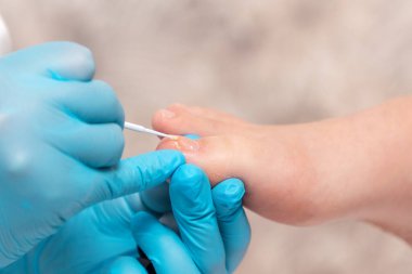 A pedicurist in blue gloves does a caring procedure for the client's nails. Close-up. The concept of podology and chiropody. clipart