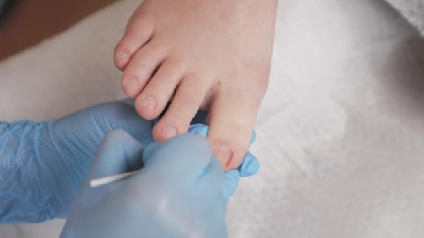 Pedicurist Leczenie Paznokcie Wacikiem Lekiem Zwolnij Mistrzu Podologia Pediatria Koncepcja — Wideo stockowe