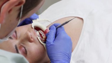 Dişçi muayenehanesindeki randevusundaki Kafkas genç bayanın yakın çekimi. Ortodontist, müşterinin dişlerindeki bağlama tellerini tamir ediyor. Ortodonti tedavisi kavramı