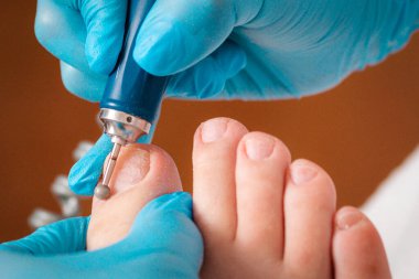 Podoloji. Pedikür ustası, parmak tırnağını dairesel başlıklı mekanik bir aletle parlatır. Yakın plan. Profesyonel manikür salonu ve kayropody konsepti..