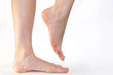 Deri topuklu kadın bacaklarının yan görüntüsü. Uzayı kopyala Beyaz arka plan. Cilt bakımı ve pedikür.