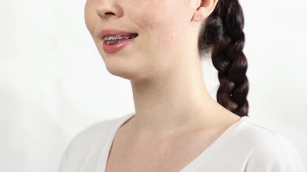 Close Mulher Jovem Sorrindo Mostra Dentes Ligadura Aparelhos Fundo Branco — Vídeo de Stock