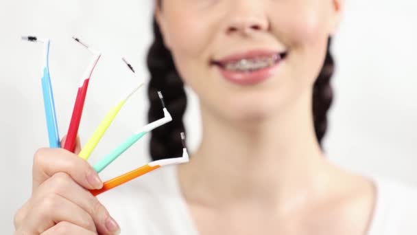 Zbliżenie Młodej Białej Uśmiechniętej Kobiety Nawiasami Zębach Pokazuje Zestaw Ortodontycznych — Wideo stockowe