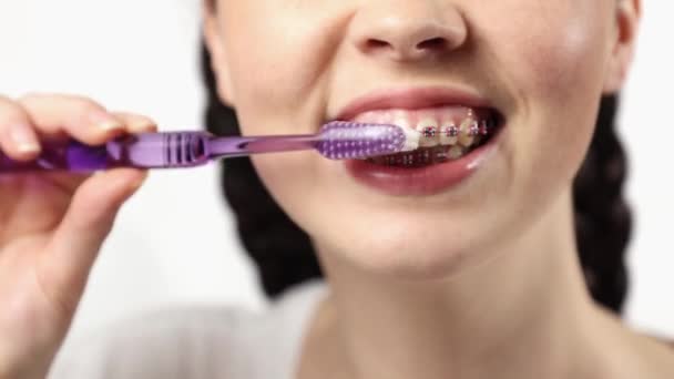 Close Mulher Caucasiana Com Aparelho Ligadura Escovar Dentes Usando Escova — Vídeo de Stock