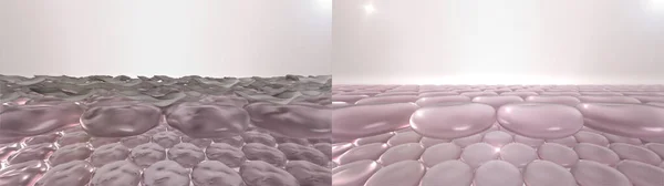 Comparison of skin with dry dead cells and impurities layer and clean healthy skin after peeling. 3d render