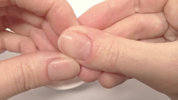 Undersøkelse Diagnose Tilstanden Til Helsen Til Negler Hvite Flekker Symptomer – stockvideo