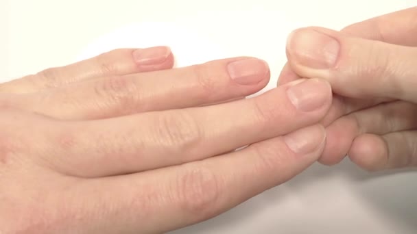 Witte Vlekken Nagels Symptomen Van Ijzertekort Bloedarmoede Onderzoek Diagnose Van — Stockvideo