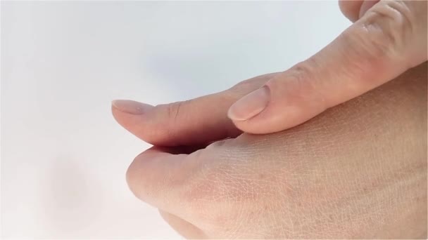 ハンドスキンケア 乾燥した白い皮を脱水させた 大人の女性が手を差し伸べる 皮膚科治療 ボディ ヘルスケア 医学コンセプト — ストック動画