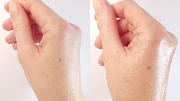 Péče Ženskou Ruku Porovnání Suché Pokožky Ruky Zdravé Hydratované Aplikaci — Stock video