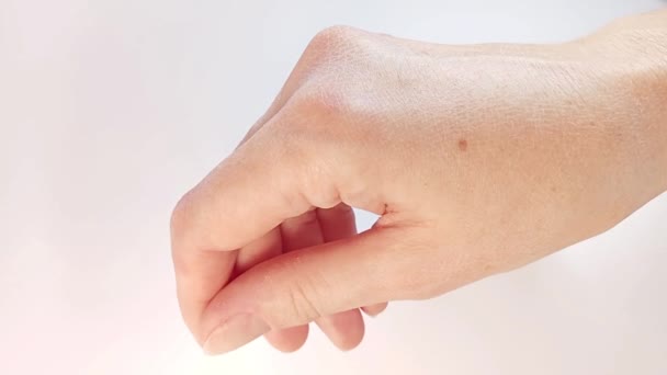 手の乾燥した肌 アレルギー 低体温 手の皮膚の脱水 スキンケアのコンセプト 女性の手を閉じる — ストック動画