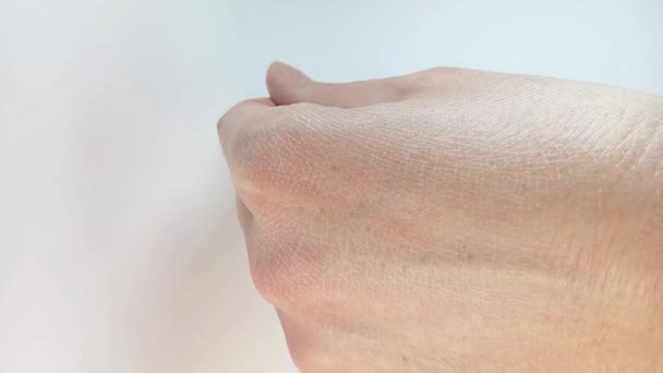 Mulher Aplicando Creme Hidratante Para Pele Mão Rachada Seca Close — Vídeo de Stock