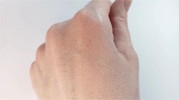 Φροντίδα Δέρματος Χεριών Αφυδατωμένο Ξηρό Λευκό Ανθρώπινο Δέρμα Μια Γυναίκα — Αρχείο Βίντεο