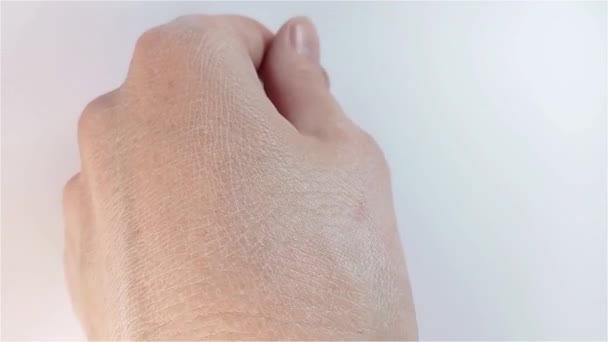 Pele Seca Das Mãos Visão Perto Mão Feminina Com Pele — Vídeo de Stock