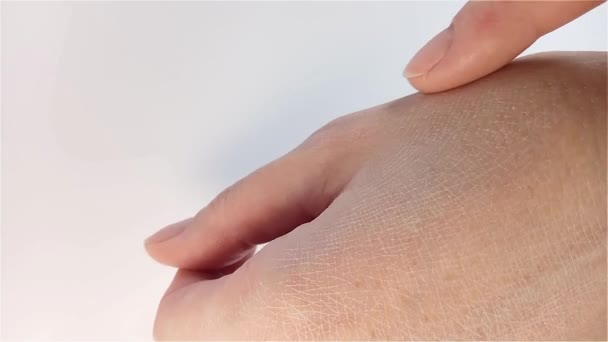 ドライハンドスキン 女性はひび割れた乾燥した皮膚で彼女の手を示しています クローズアップビュー 皮膚科治療 ボディ ヘルスケア 医学コンセプト — ストック動画