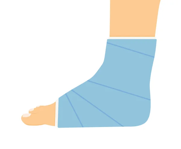 Сломанная Нога Штукатуркой Векторная Иллюстрация — стоковый вектор