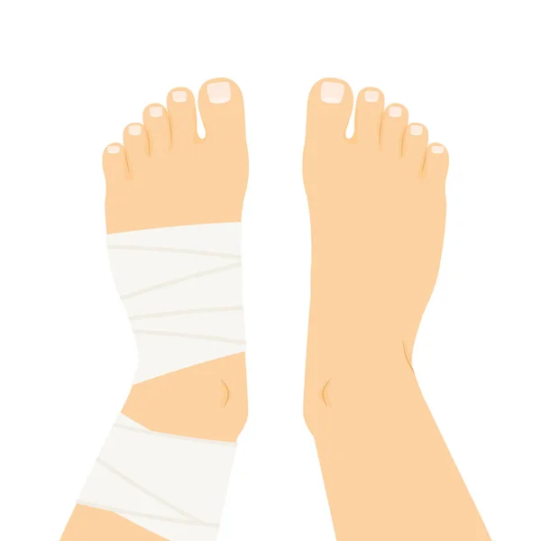 Compression Bandage Wrapped Twisted Ankle Vector Illustration — Stock Vector