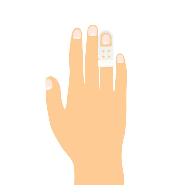 Justerbar Spjälskydd Bruten Finger Vektor Illustration — Stock vektor
