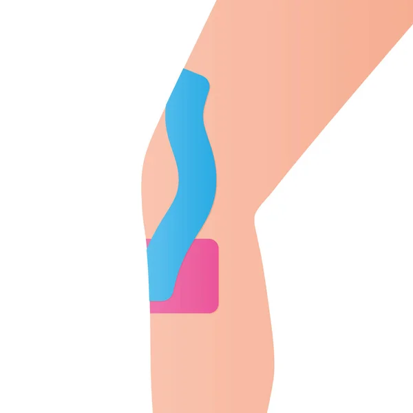 Kinesiotape Auf Dem Knie Des Patienten Vektorillustration — Stockvektor