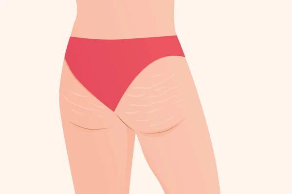 Kvinna Skinkor Med Streck Marker Vektor Illustration — Stock vektor