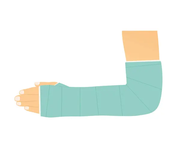 Broken Arm Plaster Vector Illustration — Stock Vector