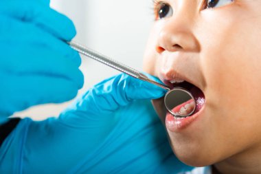 Diş hekimi çocuk sağlık muayenesi. Küçük tatlı kız için muayene prosedürü uygulayan Asyalı dişçi küçük çocuğun ağız boşluğunu muayene ediyor diş boşluğunu kontrol etmek için ağız aynası kullanıyor.