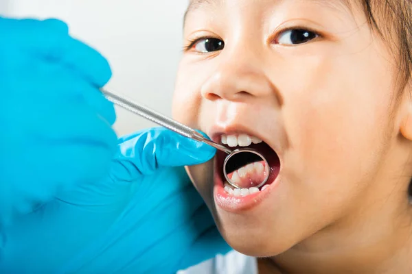 stock image Dental kid health examination. Doctor examines oral cavity of little child uses mouth mirror to checking teeth cavity, Asian dentist making examination procedure for smiling cute little girl