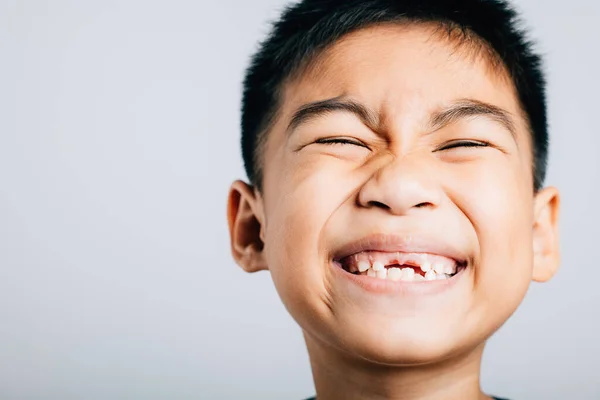 Miúdo Sorridente Dentes Superiores Perdidos Crescimento Dentário Infantil Isolado Branco — Fotografia de Stock