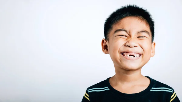 Schoolboy Sorri Dente Superior Perdido Lacuna Mostrado Sorriso Cuidados Dentários — Fotografia de Stock