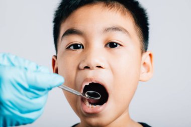 Bir pediatrik dişçi gevşek bir süt dişini çıkardıktan sonra bir çocuğun ağzını muayene eder. Diş aletleri, diş muayenesinde diş muayenehanesi ortamında yardımcı olur. Doktor diş boşluğunu kontrol etmek için ağız aynası kullanıyor.