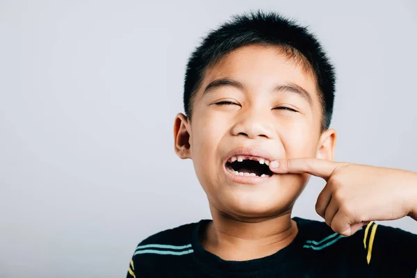 Ragazzo Asiatico Con Dente Anteriore Mancante Simboleggia Assistenza Sanitaria Dentale — Foto Stock