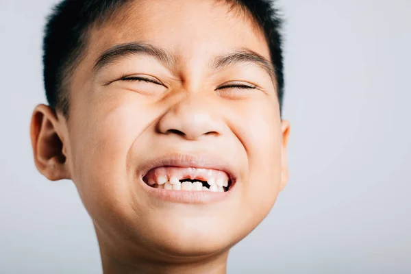 Χαμογελώντας Δόντι Του Μαθητή Έχασε Κενό Παιδικό Απομονωμένο Πορτραίτο Λευκό — Φωτογραφία Αρχείου
