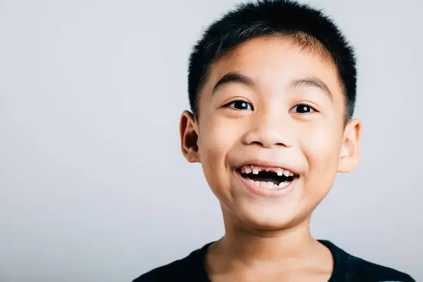 Glimlachende Schooljongen Brutale Grijns Toont Verloren Melktand Kloof Kindertandheelkundige Zorg — Stockfoto
