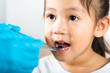 Diş hekimi çocuk sağlık muayenesi. Doktor küçük bir çocuğun ağız boşluğunu inceliyor diş boşluğunu kontrol etmek için ağız aynası kullanıyor, Asyalı dişçi gülümseyen küçük kız için muayene prosedürü yapıyor.