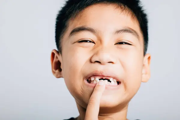 stock image Preschooler wide grin shows growing molar gap signifying child dental exfoliation. happy portrait of six year old in delightful phase of losing baby teeth. teeth new gap dentist problems