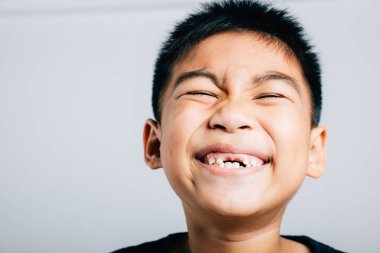 Neşeli öğrenci sırıtışı diş aralığını kaybetti. Çocuk diş büyümesi beyazda izole edilmiş. Neşeli diş perisi anı. Çocuklar yeni dişler gösteriyor, dişçi problemleri. Küçük çocuk diş yok.