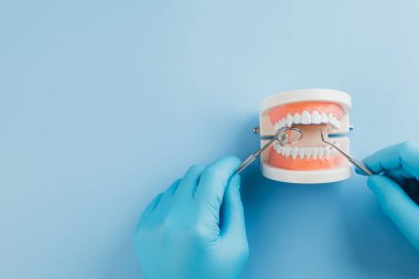 Dişçi günü konsepti. Eldivenli bir dişçi, mavi üzerine bir diş modelini kontrol etmek için sonda ve ayna tutuyor. Dünya Ağız Sağlığı Günü 'nde dişçiler, diş bakımı ve diş hekimliği pratiği kutlanıyor. Düz yatış, Üst Görünüm