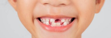 Dişi eksik mutlu bir çocuk ışıl ışıl gülümser. Diş hekimi diş dökülmesi üzerine eğitim veriyor, ebeveynlerin bebek dişlerinin doğal aşamalarını anlamalarına yardımcı oluyor. Yakın çekim