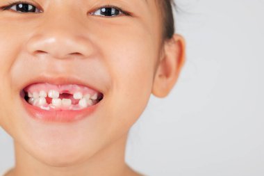 Gülümseyen bir kız kayıp dişini gösterir. Diş hekimi diş dökülmesini ve diş bakımını tartışarak, bebek dişlerinin dökülmesinin ve yeni dişlerin çıkmasının doğal sürecini vurguluyor. Kapat.