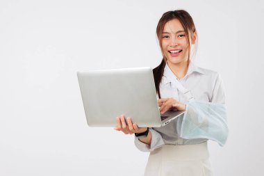 Kırık kolu alçıda olan genç bir kadın laptopunu kullanıyor, yaralanmasına rağmen gülümsüyor, dizüstü bilgisayarında çalışırken kol desteği görülebiliyor ve üretken kalıyor, vesikalık fotoğraf stüdyo beyaz arka plan