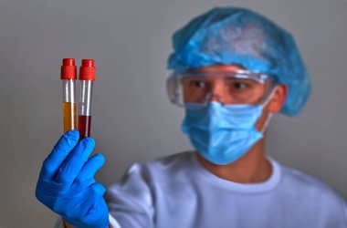 Koronavirüs COVID19, HIV, ebola ya da diğer tehlikeli enfeksiyonlar için kan testi yapan maskeli bir doktor. Doktor portresi, tıbbi geçmiş, şablon, duvar kağıdı. Coronavirus hastalığı 