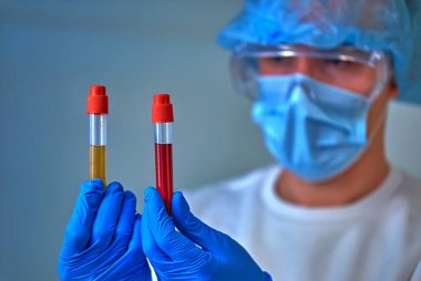 Kan testi tüpleri, koronavirüs COVID19, HIV, ebola veya diğer tehlikeli enfeksiyonları tutan maskeli bir doktor. Tıbbi geçmiş, enstrümanlar, şablon, duvar kağıdı. Coronavirus hastalığı konsepti. Doktor portresi