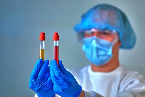 Doctor in mask holding the blood test tubes, coronavirus COVID19, HIV, ebola or other dangerous infection. Medical background, instruments, template, wallpaper. Coronavirus disease concept. Doctor portrait