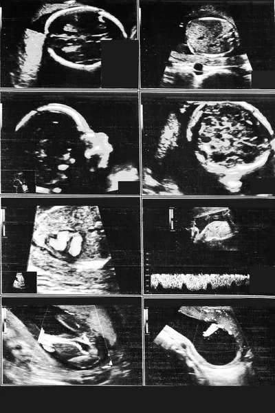 Imagem Ultra Som Bebê Memória Fotografia Maternidade — Fotografia de Stock