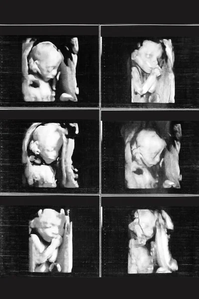 Ultrazvuk Obrázek Dítě Paměť Fotografie Mateřství — Stock fotografie