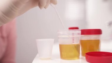 Konteynırdan idrar örneği alıp bir pipetten plastik bardağa attığını gösteren bir gösteri videosu..