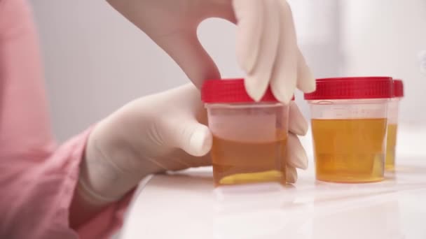 容器から尿を採取する医療用ラテックス手袋の女性の手のクローズアップ — ストック動画
