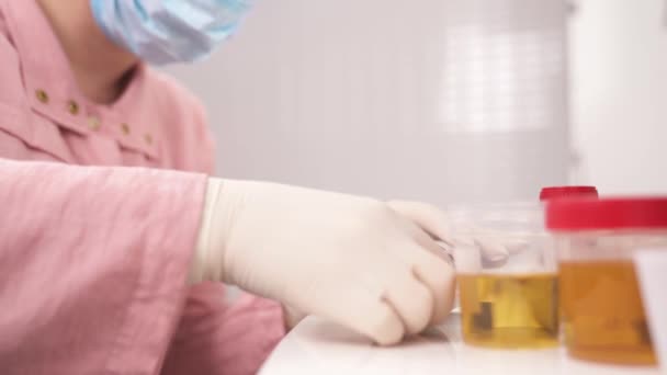 Gros Plan Scientifique Laboratoire Médical Plongeant Bandelette Dans Échantillon Urine — Video